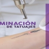 Space Laser Mx